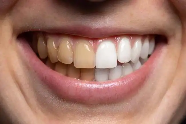 featured image